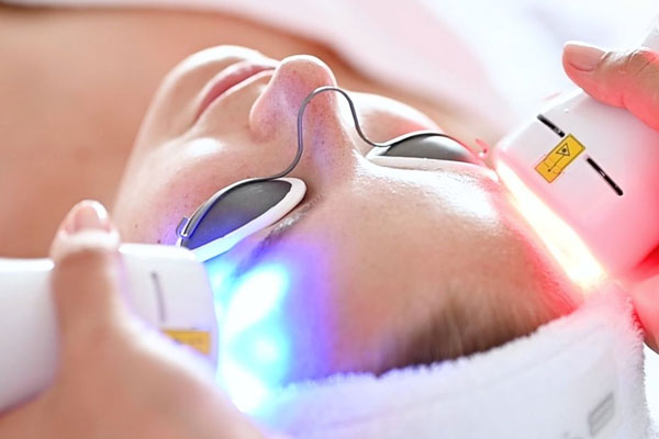Bild einer Laserbehandlung